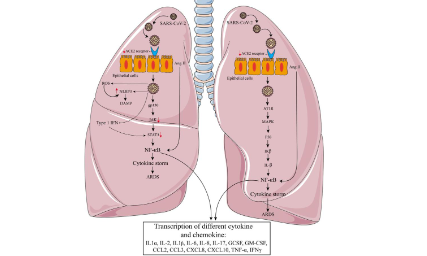 SXR2023030027C+COVID-19中的免疫衰老和炎症衰老
